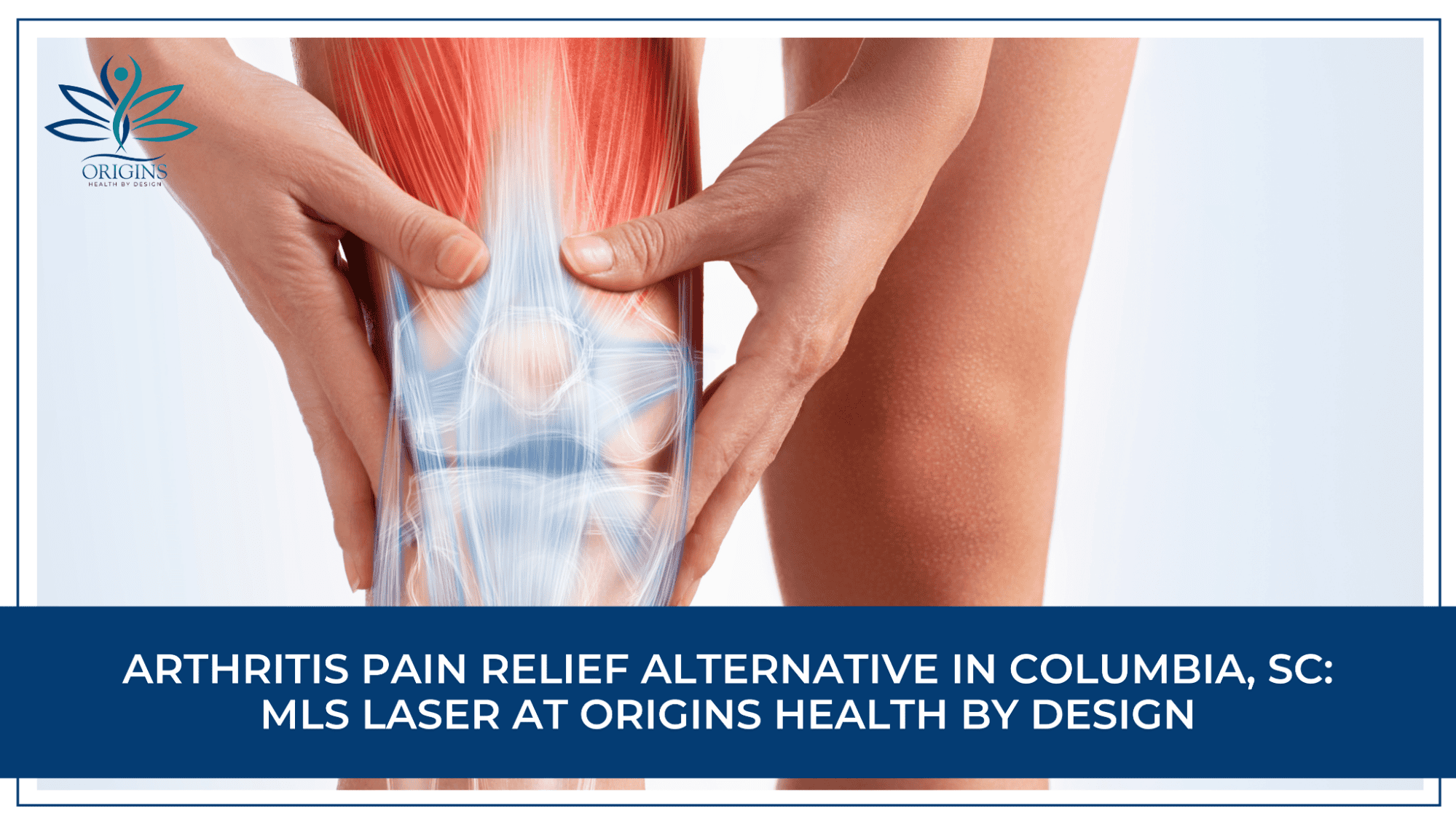 Arthritis Pain Relief Alternative in Columbia, SC: MLS Laser at Origins Health by Design